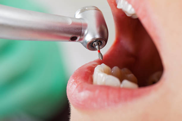 Best Emergency Broken Tooth Repair in Gowanda, NY